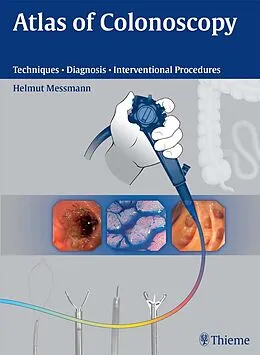 E-Book (epub) Atlas of Colonoscopy von Helmut Messmann