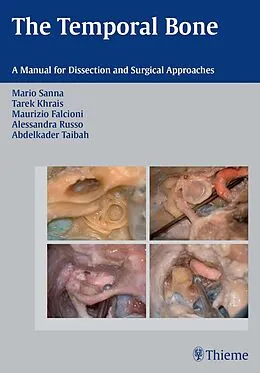 E-Book (epub) The Temporal Bone von Mario Sanna, Tarek Khrais, Maurizio Falcioni