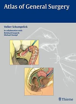 E-Book (epub) Atlas of General Surgery von Volker Schumpelick