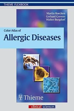 E-Book (epub) Color Atlas of Allergic Diseases von Gerhard Grevers, Walter Burgdorf, Martin Röcken