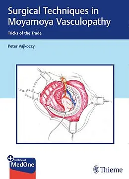 E-Book (epub) Surgical Techniques in Moyamoya Vasculopathy von Peter Vajkoczy