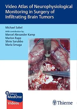 E-Book (epub) Video Atlas of Neurophysiological Monitoring in Surgery of Infiltrating Brain Tumors von Michael Christoph Sabel