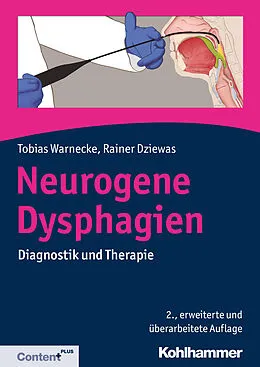 E-Book (pdf) Neurogene Dysphagien von Tobias Warnecke, Rainer Dziewas