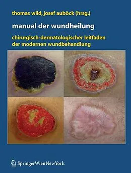 E-Book (pdf) Manual der Wundheilung von Thomas Wild, Josef Auböck