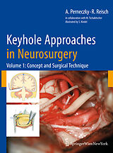 E-Book (pdf) Keyhole Approaches in Neurosurgery von Axel Perneczky, Robert Reisch