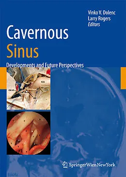E-Book (pdf) Cavernous Sinus von Vinko V. Dolenc, Larry Rogers