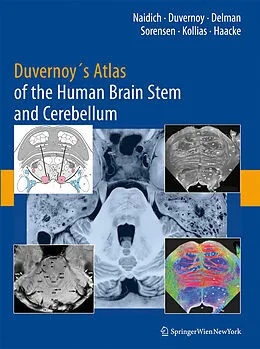 E-Book (pdf) Duvernoy's Atlas of the Human Brain Stem and Cerebellum von Thomas P. Naidich, Henri M. Duvernoy, Bradley N. Delman