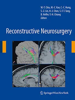 E-Book (pdf) Reconstructive Neurosurgery von Yung-Hsiao Chiang, Barry J. Hoffer, Simon F. T. Tang