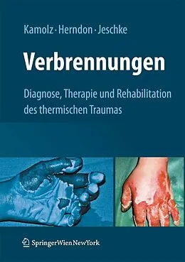 E-Book (pdf) Verbrennungen von Lars-Peter Kamolz, David N. Herndon, Marc G. Jeschke
