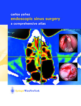 Fester Einband Endoscopic Sinus Surgery von Carlos Yañez