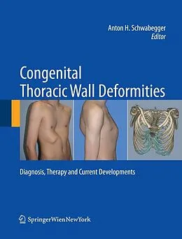 E-Book (pdf) Congenital Thoracic Wall Deformities von Anton H. Schwabegger