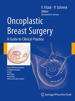 E-Book (pdf) Oncoplastic Breast Surgery von Florian Fitzal, Peter Schrenk