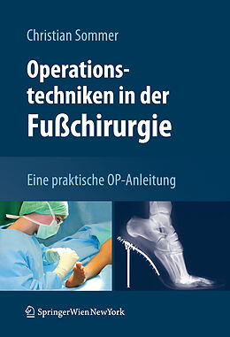 Fester Einband Operationstechniken in der Fußchirurgie von Christian Sommer