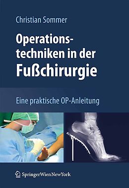 E-Book (pdf) Operationstechniken in der Fußchirurgie von Christian Sommer