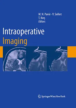 E-Book (pdf) Intraoperative Imaging von M. Necmettin Pamir, Volker Seifert, Talat Kiris