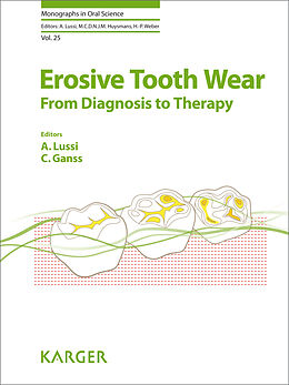 eBook (pdf) Erosive Tooth Wear de 