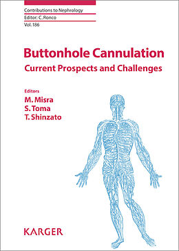 eBook (pdf) Buttonhole Cannulation de 
