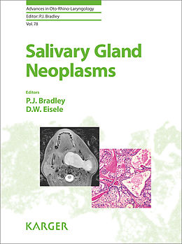 eBook (pdf) Salivary Gland Neoplasms de 