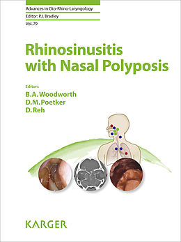 eBook (pdf) Rhinosinusitis with Nasal Polyposis de 