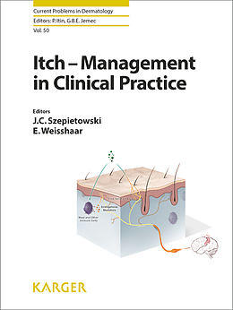 eBook (pdf) Itch - Management in Clinical Practice de 