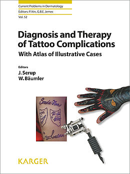 E-Book (pdf) Diagnosis and Therapy of Tattoo Complications von 