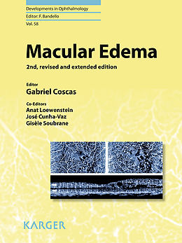 eBook (pdf) Macular Edema de 