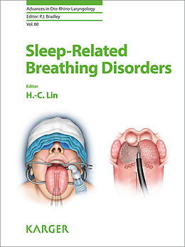 eBook (pdf) Sleep-Related Breathing Disorders de 