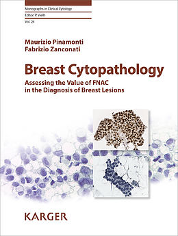 eBook (pdf) Breast Cytopathology de M. Pinamonti, F. Zanconati