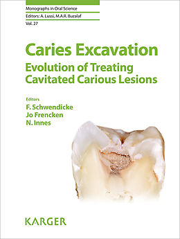 eBook (pdf) Caries Excavation: Evolution of Treating Cavitated Carious Lesions de 