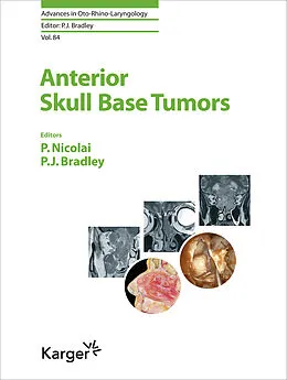 eBook (pdf) Anterior Skull Base Tumors de 