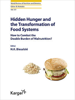 Livre Relié Hidden Hunger and the Transformation of Food Systems de 