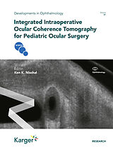 E-Book (pdf) Integrated Intraoperative Ocular Coherence Tomography for Pediatric Ocular Surgery von 