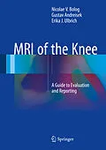 E-Book (pdf) MRI of the Knee von Nicolae V. Bolog, Gustav Andreisek, Erika J. Ulbrich
