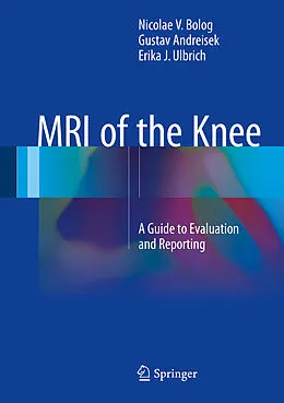 E-Book (pdf) MRI of the Knee von Nicolae V. Bolog, Gustav Andreisek, Erika J. Ulbrich