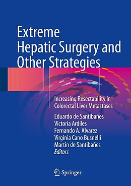 eBook (pdf) Extreme Hepatic Surgery and Other Strategies de 