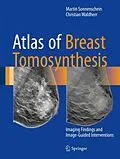 E-Book (pdf) Atlas of Breast Tomosynthesis von Martin Sonnenschein, Christian Waldherr