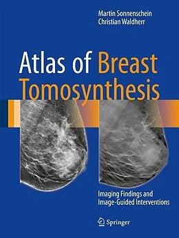E-Book (pdf) Atlas of Breast Tomosynthesis von Martin Sonnenschein, Christian Waldherr