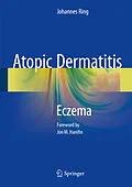 E-Book (pdf) Atopic Dermatitis von Johannes Ring