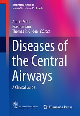 Fester Einband Diseases of the Central Airways von 