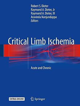 eBook (pdf) Critical Limb Ischemia de 