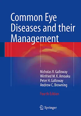 E-Book (pdf) Common Eye Diseases and their Management von Nicholas R. Galloway, Winfried M. K. Amoaku, Peter H. Galloway