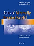 E-Book (pdf) Atlas of Minimally Invasive Facelift von Jose Maria Serra-Renom, Jose Maria Serra-Mestre