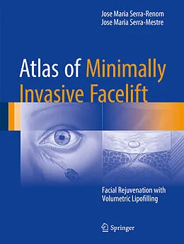E-Book (pdf) Atlas of Minimally Invasive Facelift von Jose Maria Serra-Renom, Jose Maria Serra-Mestre