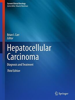eBook (pdf) Hepatocellular Carcinoma de 