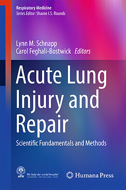 Livre Relié Acute Lung Injury and Repair de 