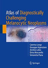 eBook (pdf) Atlas of Diagnostically Challenging Melanocytic Neoplasms de Caterina Longo, Giuseppe Argenziano, Aimilios Lallas