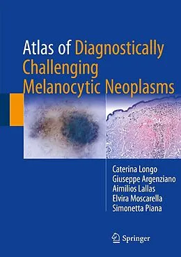 E-Book (pdf) Atlas of Diagnostically Challenging Melanocytic Neoplasms von Caterina Longo, Giuseppe Argenziano, Aimilios Lallas
