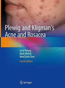 E-Book (pdf) Plewig and Kligman´s Acne and Rosacea von Gerd Plewig, Bodo Melnik, Wenchieh Chen