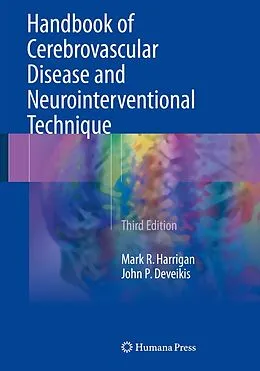E-Book (pdf) Handbook of Cerebrovascular Disease and Neurointerventional Technique von Mark R. Harrigan, John P. Deveikis