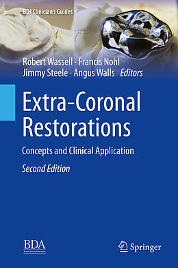 eBook (pdf) Extra-Coronal Restorations de 